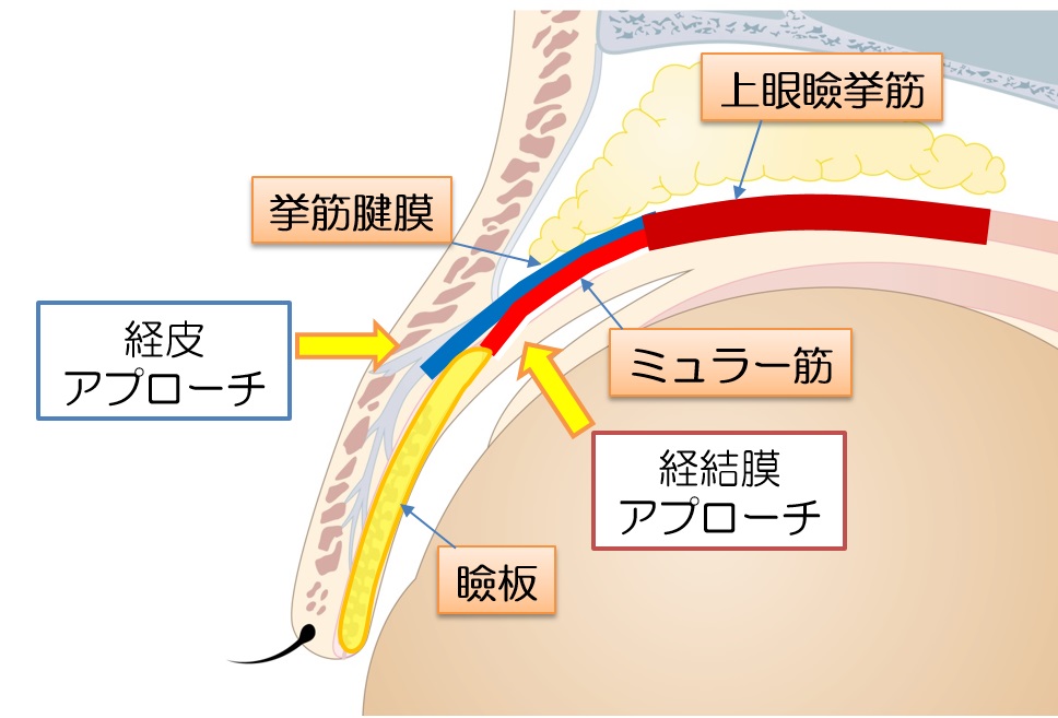 図１