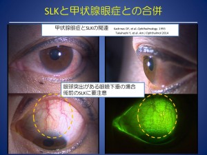 スライド35