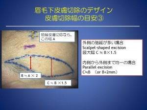 スライド25