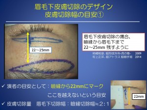スライド23